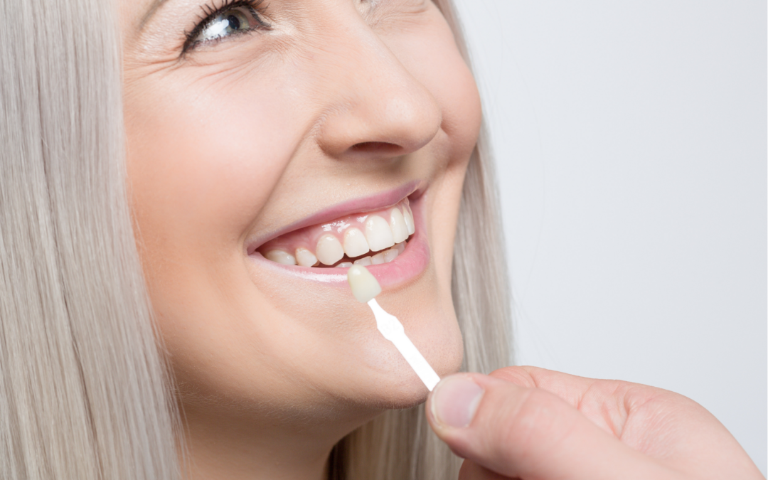 Transform Your Smile: Why Veneers Are the Perfect Choice?
